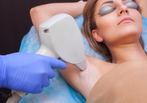 Does Laser Hair Removal Work Permanently? - An Expert's Perspective