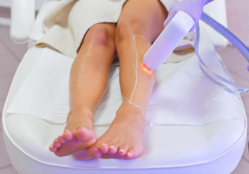 Who Should Not Get Laser Hair Removal? - An Expert's Perspective